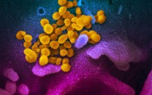 Coronavirus epidemic: a short survey